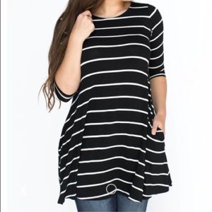 Striped tunic